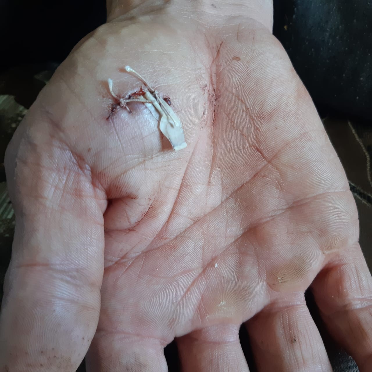 Астраханец пытаясь защитить кур, пострадал от бродячих собак