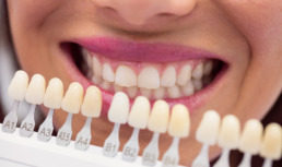 отбеливание зубов (фото ru.freepik.com)