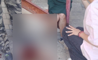 «Оторвала целый кусок кожи»: в Астрахани собака напала на пожилую женщину
