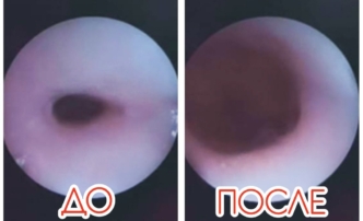 В Астрахани на свет появился ребенок с&nbsp;редким врожденным пороком